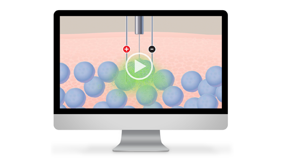 Electroporation Video